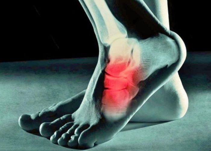 Inversion Foot Causes Symptoms and Treatment Options