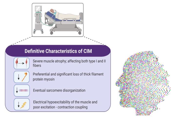 Critical Illness Myopathy and Its Effects