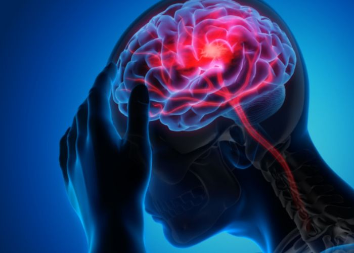 Contusion in Brain Causes